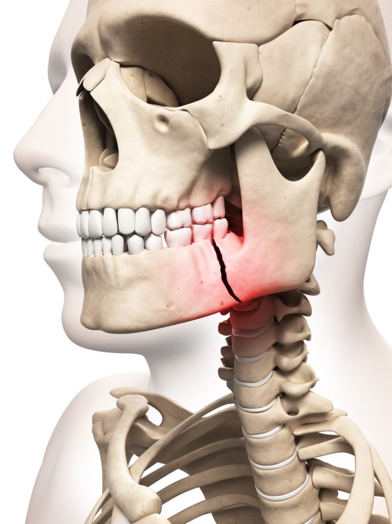 FACIAL TRAUMA - Aspen Oral And Facial Surgery